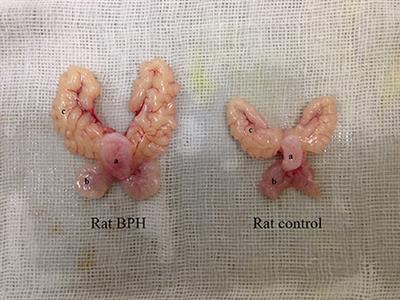 Upregulation of Oxytocin Receptor in the Hyperplastic Prostate